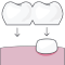 Необходимость восстановления нескольких зубов сразу – мостовидные протезы