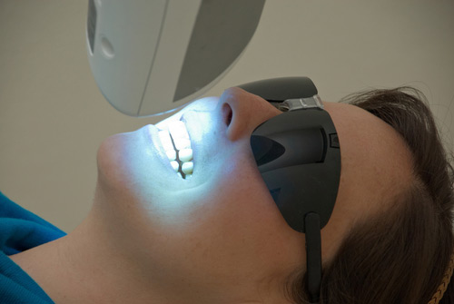 Стоматологическое отбеливание зубов лазером