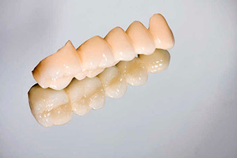 Протезирование зубов изображение 5