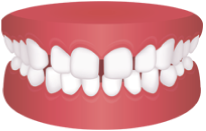 Промежутки между зубами