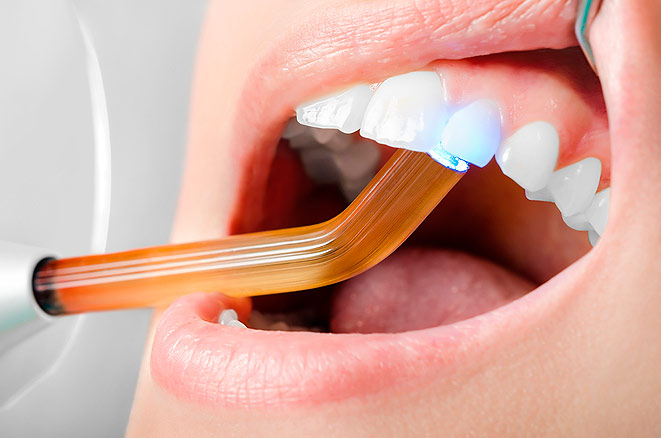Реставрация зубов пломбировочным материалом: показания и противопоказания