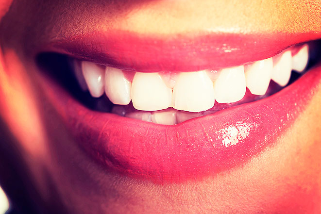 Отбеливание зубов может стать навязчивой идеей