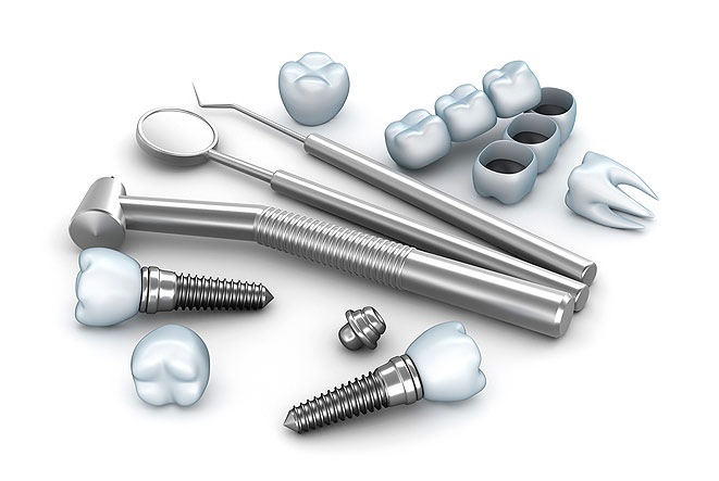 Имплантология зубов: все, что вы хотели знать