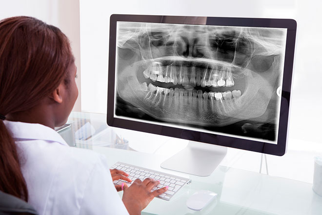 Визит к стоматологу расскажет о состоянии костей