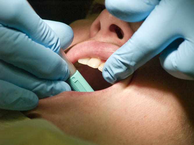 Имплантация зубов эндоскопическим методом