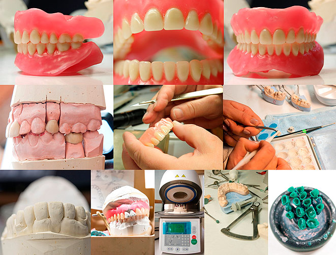 О срочном ремонте зубных протезов