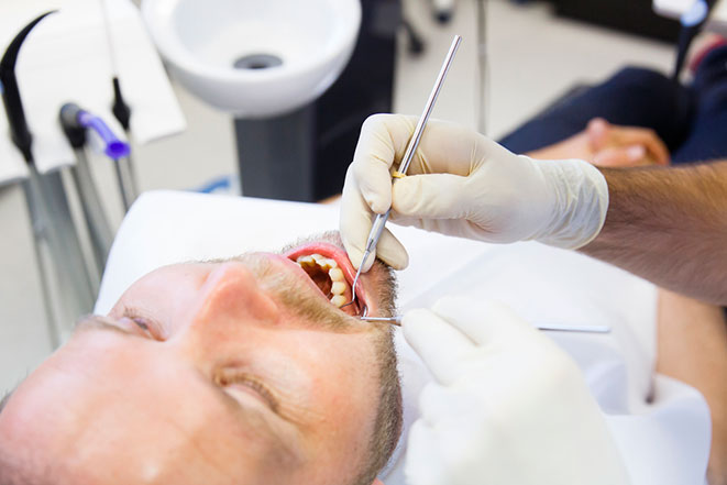 Что такое резекция кисты зуба?