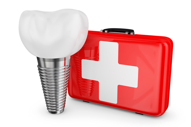 Анестезия и обезболивание в стоматологии при имплантации зубов