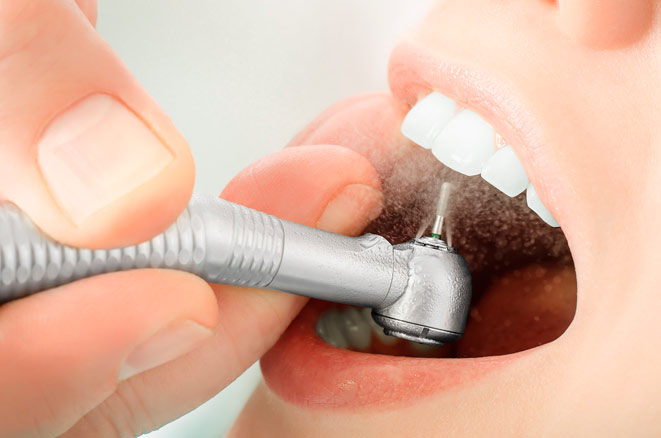 В чем различие разных видов зубных пломб