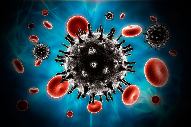 Заболевания пародонта могут спровоцировать раннюю активизацию ВИЧ