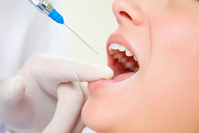 Обзор видов анестезии в стоматологии. Часть третья