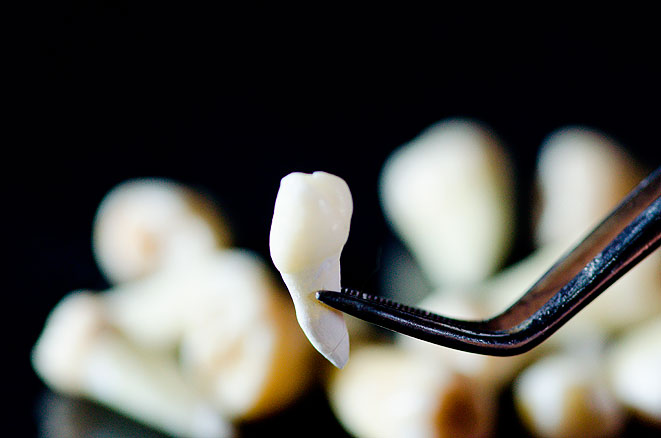 Послеоперационный период после удаления зуба