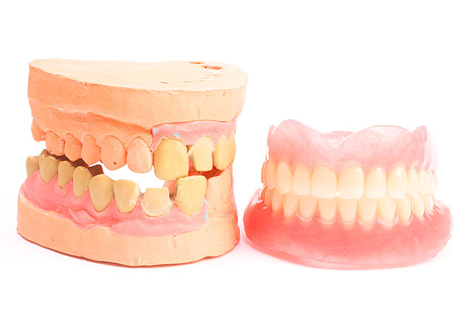 Что делать при натертости от зубных протезов?