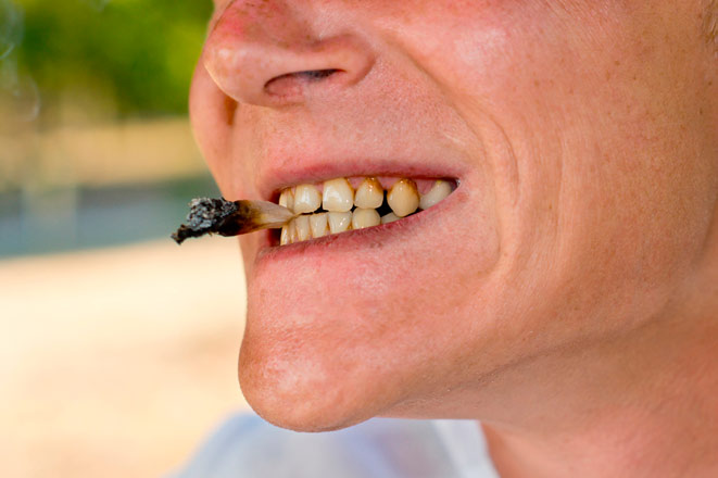 Ученые рассказали, почему красивые зубы отсутствуют у курильщиков