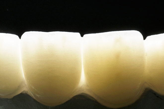 Получена методика создания композита, имеющего все свойства естественных тканей зубов