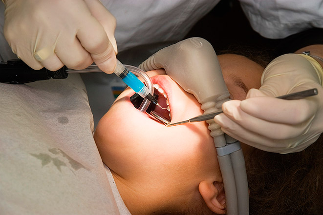 Особенности анестезии в детской стоматологии