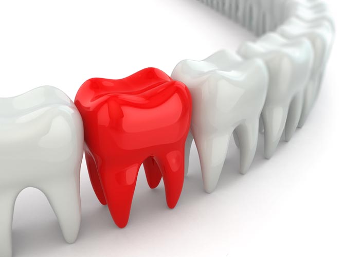 Какие лучшие импланты зубов по производителю? Часть 2