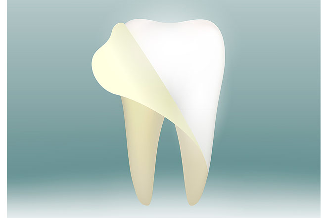 Что такое белый налет на зубах, и как с ним бороться