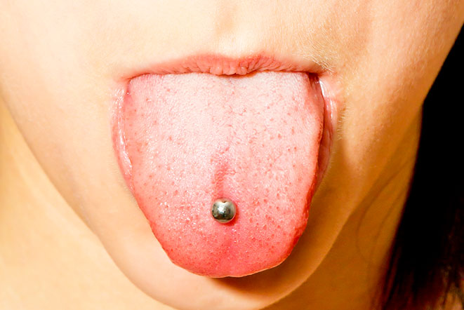 Пирсинг языка ведет к болезням ротовой полости