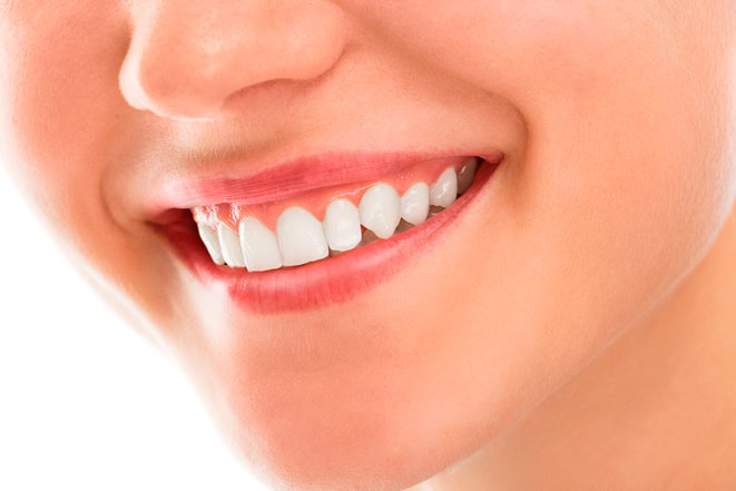 Виниры  – идеальные зубы без особых проблем