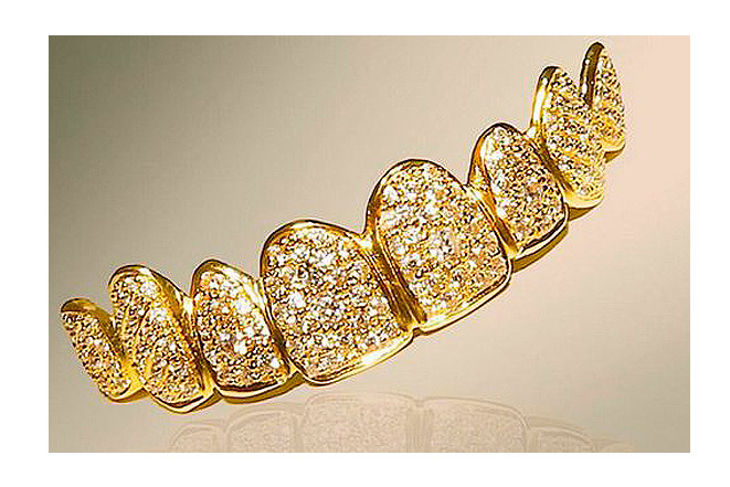 Сверкание золота на зубах – новый писк зубной моды