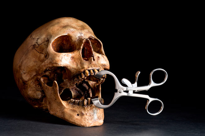 Щипцы для удаления зубов пригодились стоматологам при проведении исследований древних черепов