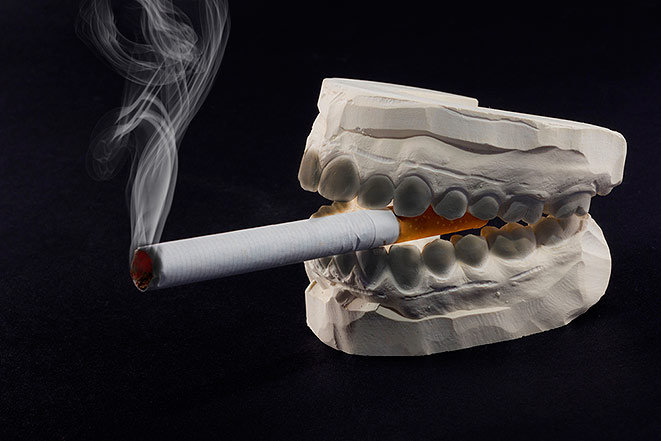 Курение способствует утрате зубов