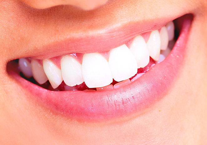 Плюсы зеленого биоотбеливания зубов