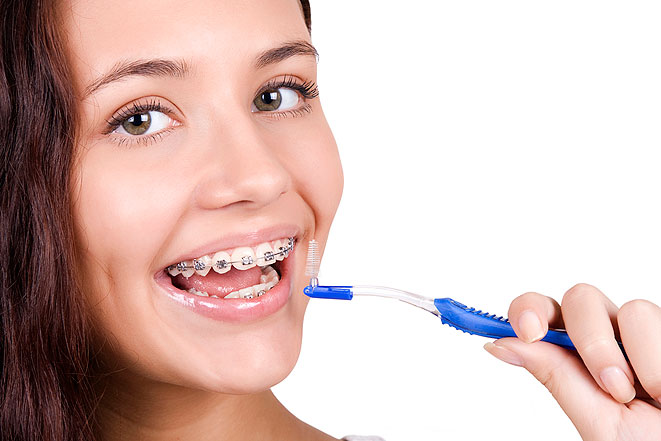 От того, как ухаживать за брекетами, напрямую зависит состояние зубов