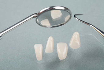 Протезирование зубов изображение 7