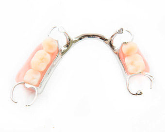 Протезирование зубов изображение 2