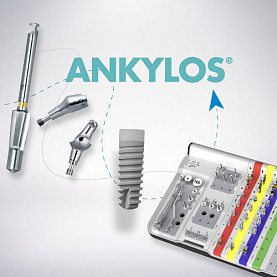 Импланты Ankylos (Германия): отзывы, цены, особенности