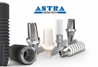 Импланты Astra Tech: отзывы специалистов и пациентов