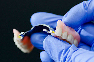 Сломался протез! Возможен ли ремонт зубных протезов?