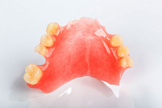 Преимущества и недостатки мягких зубных протезов